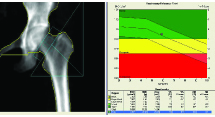 bone mineral density (BMD) scan